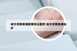哈爾濱銀屑病就看祥云醫(yī)院 哈爾濱銀屑病治療