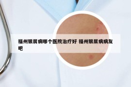 福州銀屑病哪個(gè)醫(yī)院治療好 福州銀屑病病友吧